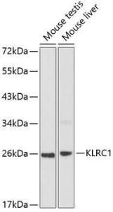 Western blot analysis of extracts of various cell lines, using Anti-NKG2A Antibody (A8892) at 1:1,000 dilution