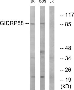 Western blot analysis of lysates from Jurkat and COS cells using Anti-GIDRP88 Antibody The right hand lane represents a negative control, where the antibody is blocked by the immunising peptide