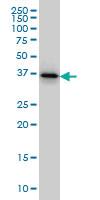 Anti-TWF1 Mouse Monoclonal Antibody [clone: 1E2]