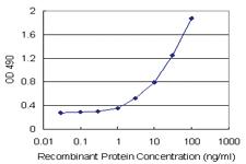 Anti-TANK Polyclonal Antibody Pair