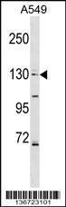 Anti-COL4A6 Rabbit Polyclonal Antibody (HRP (Horseradish Peroxidase))