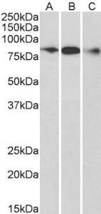 Anti-ELMO1 Antibody (A83392) (0.3 µg/ml) staining of Human Frontal Cortex (A), Mouse (B) and Rat (C) Brain lysate (35 µg protein in RIPA buffer). Primary incubation was 1 hour. Detected by chemilu minescence