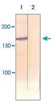 Anti-IRS1 Rabbit Polyclonal Antibody