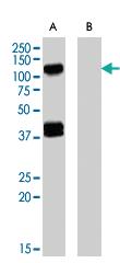 Anti-EPB41L2 Goat Polyclonal Antibody