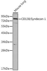 Western blot analysis of extracts of Mouse lung cells, using Anti-Syndecan-1 Antibody (A8893) at 1:1,000 dilution. The secondary antibody was Goat Anti-Rabbit IgG H&L Antibody (HRP) at 1:10,000 dilution.