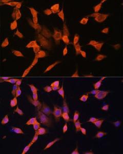 Immunofluorescence analysis of NIH/3T3 cells using Anti-PRKAR1A Antibody (A305279) at a dilution of 1:100. DAPI was used to stain the cell nuclei (blue).