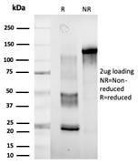 SDS-PAGE analysis of Anti-DDX41 Antibody [PCRP-DDX41-1B4] under non-reduced and reduced conditions; showing intact IgG and intact heavy and light chains, respectively. SDS-PAGE analysis confirms the integrity and purity of the antibody