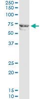 Anti-MMP12 Rabbit Polyclonal Antibody