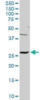 Anti-HYI Rabbit Polyclonal Antibody