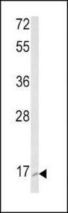 Anti-RAC2 Rabbit Polyclonal Antibody (AP (Alkaline Phosphatase))