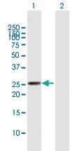 Anti-AK4 Mouse Polyclonal Antibody