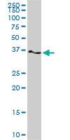 Anti-TWF1 Mouse Monoclonal Antibody [clone: 1E2]