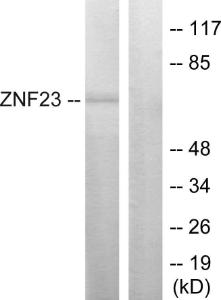 Western blot analysis of lysates from LOVO cells using Anti-ZNF23 Antibody. The right hand lane represents a negative control, where the antibody is blocked by the immunising peptide.