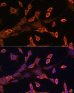 Immunofluorescence analysis of NIH/3T3 cells using Anti-PRKAR1A Antibody (A305279) at a dilution of 1:100. DAPI was used to stain the cell nuclei (blue).