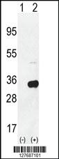 Anti-RPS6 Rabbit Polyclonal Antibody