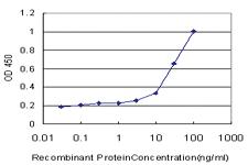 Anti-CAMK2A Mouse Monoclonal Antibody [clone: 1C6]