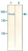 Anti-IRS2 Rabbit Polyclonal Antibody