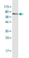 Anti-PSAP Mouse Monoclonal Antibody [clone: 3B12]