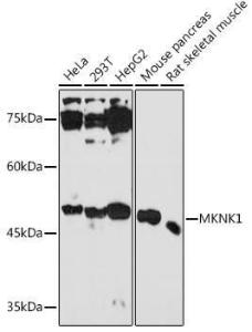 Western blot analysis of extracts of various cell lines, using Anti-MNK1 Antibody (A309108) at 1:1,000 dilution. The secondary antibody was Goat Anti-Rabbit IgG H&L Antibody (HRP) at 1:10,000 dilution.