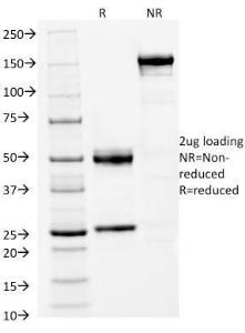 SDS-PAGE analysis of Anti-FOXA1 Antibody [FOXA1/1512] under non-reduced and reduced conditions; showing intact IgG and intact heavy and light chains, respectively. SDS-PAGE analysis confirms the integrity and purity of the antibody.