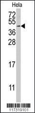 Anti-RFC5 Rabbit Polyclonal Antibody