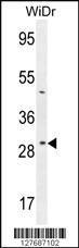 Anti-RPS6 Rabbit Polyclonal Antibody