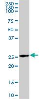 Anti-AK4 Mouse Polyclonal Antibody