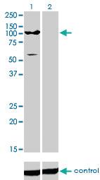 Anti-ATP2C1 Mouse Monoclonal Antibody [clone: 2G1]