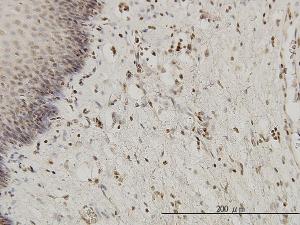 Anti-HYI Mouse Monoclonal Antibody [clone: 2A2]