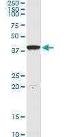 Anti-DNAJB4 Antibody Pair