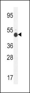 Anti-GCNT2 Rabbit Polyclonal Antibody (Biotin)