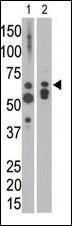 Anti-MTM1 Rabbit Polyclonal Antibody (APC (Allophycocyanin))