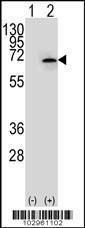 Anti-NEK3 Rabbit Polyclonal Antibody (HRP (Horseradish Peroxidase))