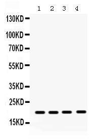 Anti-NME1 Rabbit Polyclonal Antibody