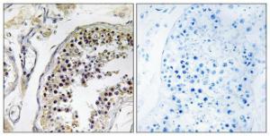 Immunohistochemical analysis of paraffin-embedded human testis tissue using Anti-CNOT4 Antibody. The right hand panel represents a negative control, where the antibody was pre-incubated with the immunising peptide