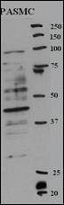 Anti-RFC5 Rabbit Polyclonal Antibody