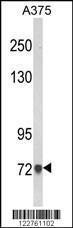 Anti-AMOTL2 Rabbit Polyclonal Antibody (Biotin)