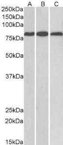 Anti-MID2 antibody