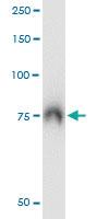 Anti-ABCF2 Mouse Monoclonal Antibody [clone: 1D11]