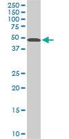 Anti-STK38 Mouse Monoclonal Antibody [clone: 2F3]