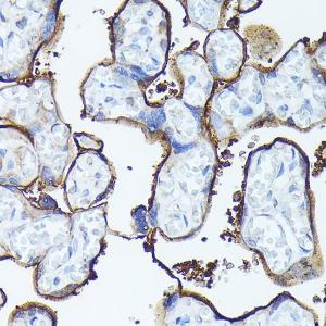 Immunohistochemistry analysis of paraffin-embedded human placenta using Anti-Syndecan-1 Antibody (A8893) at a dilution of 1:100 (40x lens). Perform high pressure antigen retrieval with 10 mM citrate buffer pH 6.0 before commencing with IHC staining protocol.