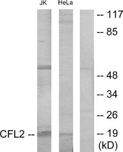 Western blot analysis of lysates from Jurkat and HeLa cells using Anti-Cofilin Antibody. The right hand lane represents a negative control, where the antibody is blocked by the immunising peptide