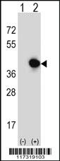 Anti-RFC5 Rabbit Polyclonal Antibody