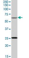 Anti-COL4A3BP Goat Polyclonal Antibody