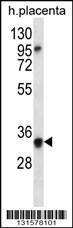 Anti-OR6N2 Rabbit Polyclonal Antibody (AP (Alkaline Phosphatase))