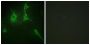 Immunofluorescence analysis of NIH/3T3 cells using Anti-Collagen IX alpha3 Antibody. The right hand panel represents a negative control, where the antibody was pre-incubated with the immunising peptide