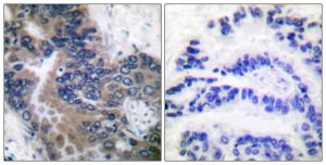 Anti-APAF-1-ALT antibody