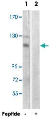 Anti-ADCY4 Rabbit Polyclonal Antibody