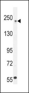 Anti-COL5A1 Rabbit Polyclonal Antibody (APC (Allophycocyanin))