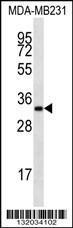 Anti-LIX1L Rabbit Polyclonal Antibody (APC (Allophycocyanin))